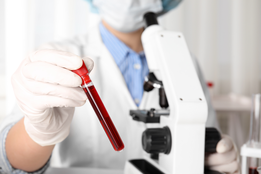 What Is a Liquid Biopsy? The Blood Test Changing Cancer Detection and Treatment